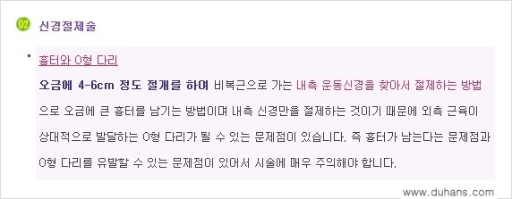 ⁠[두한성형외과 경쟁력 멀티종아리성형] - [종아리성형 방법들의 문제점 안내] 관련 이미지 3