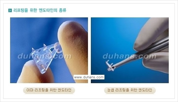 [두한성형외과 경쟁력 주름성형] - [엔도타인 리프팅 안내 ①] 관련 이미지 3