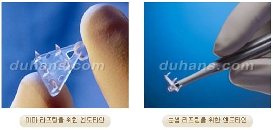 [두한성형외과 주름개선] - [주름교정 방법] 관련 이미지 11