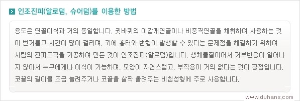 [두한성형외과 경쟁력 코성형] - [여러 가지 코성형 방법 안내] 관련 이미지 10