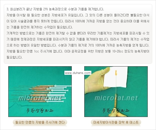 [두한성형외과의 경쟁력 미세지방이식] - [이마 미세지방이식 안내 ①] 관련 이미지 8