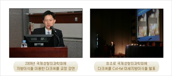 [두한성형외과 경쟁력 눈밑성형] - [눈밑 다크써클 원인과 눈밑 다크써클 치료 방법 안내] 관련 이미지 12