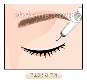 ⁠⁠[두한성형외과 경쟁력 안검성형] - [젊은 눈매를 위한 윗눈꺼풀 지방제거, 눈밑 지방제거] 관련 이미지 4