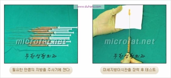 [두한성형외과 경쟁력 동안성형 리더] - ​[미간주름, 이마주름, 안검성형, 이마거상술, 눈썹거상술] 관련 이미지 29