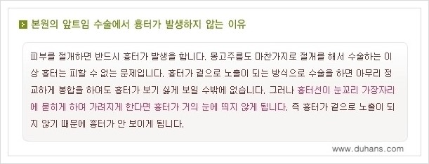 [두한성형외과 경쟁력 눈성형] - [앞트임 수술(몽고주름 제거) 안내 ①] 관련 이미지 4