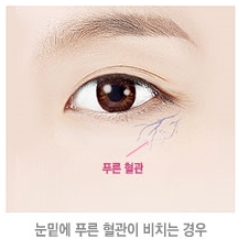 두한성형외과 눈밑수술 - 다크서클 수술 전후 관리 안내 관련 이미지 109
