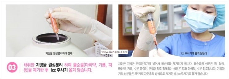[두한성형외과 경쟁력 눈밑성형] - [눈밑 다크써클 치료 - 다크써클 + 인디언밴드 콤비 프로그램] 관련 이미지 4