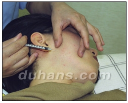 [Duhan Plastic Surgery Clinic Aesthetic Procedures] - [Square Jaw Botox] image 14
