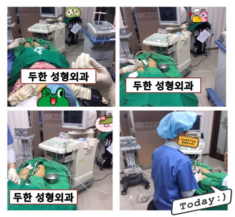 [두한성형외과-종아리축소술]-#종아리신경차단술 #종아리내측근육 #종아리외측근육 관련 이미지 1