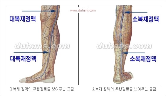 [두한성형외과 경쟁력 정맥류 치료] - [정맥류 치료의 모든 것] 관련 이미지 5