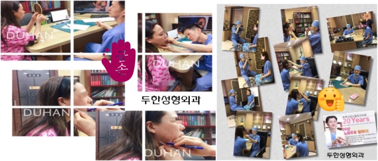 Duhan Plastic Surgery Dark Circle Improvement - What Causes Dark Circles? What Types of Dark Circles Are There? image 29