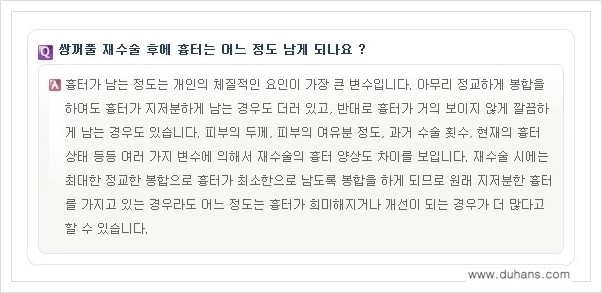 ​​[두한성형외과 경쟁력 쌍꺼풀(눈) 재수술] - [쌍꺼풀(눈) 재수술 Q&A 모음] 관련 이미지 17