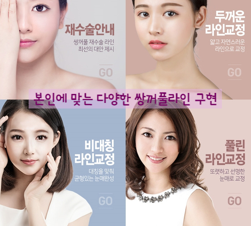 [두한성형외과 쌍수재수술] - [눈재수술에 대한 최선에 대안] 관련 이미지 114