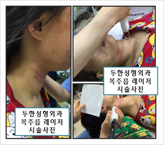 Duhan Plastic Surgery Laser Treatment - Mole Removal, Spot Removal, Melasma, Blemishes, Hyperpigmentation, Skin Tone Improvement, Elasticity Improvement, Skin Texture Improvement image 39