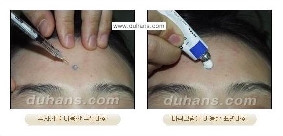 [두한성형외과 안전성형 우선주의] - [성형 통증을 최소화하는 수면마취, 무통마취 안내] 관련 이미지 3