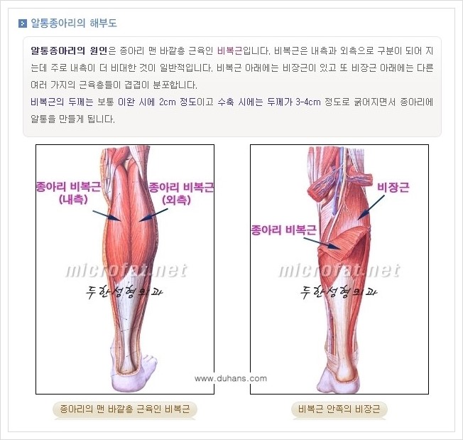 ⁠⁠⁠[두한성형외과 경쟁력 멀티종아리성형] - [굵은 알통 종아리 수술 안내 1.] 관련 이미지 4