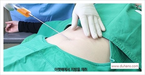 [두한성형외과 경쟁력 눈밑성형] - [눈밑 미세지방이식의 이해도 안내] 관련 이미지 4
