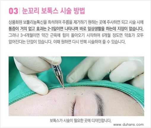 [두한성형외과 무한 경쟁력 다크써클 치료] - [다크써클 + 눈꼬리 보톡스 콤비 프로그램] 관련 이미지 2
