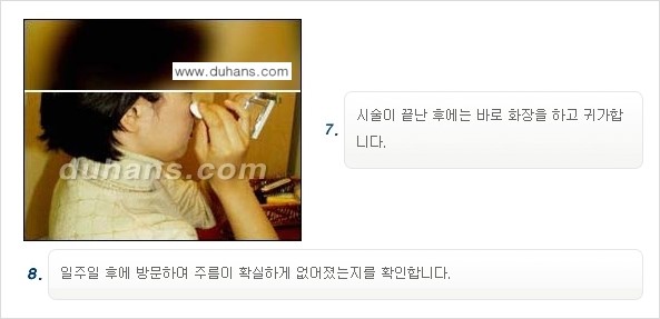 [두한성형외과 젊어지는 주름교정술] - [주름제거 시술방법 ④] 관련 이미지 10
