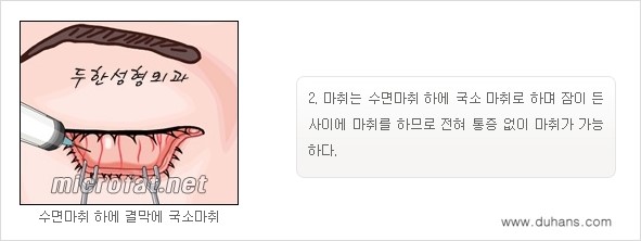 [두한성형외과 경쟁력 "지방제거"] - [눈 지방제거 1.] 관련 이미지 7