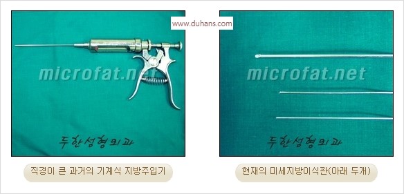 [두한성형외과 경쟁력 안면윤곽 교정] - [자연스럽고 균형있는 턱으로의 복원 미세지방이식과 간편 사각턱 보톡스 안내] 관련 이미지 34
