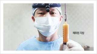 [두한성형외과 경쟁력 미세지방이식] - [부작용 없는 지방이식 시술을 위한 방법 안내] 관련 이미지 7