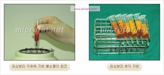 [두한성형외과 경쟁력 윤곽성형] - [볼, 볼살 지방이식] 관련 이미지 8