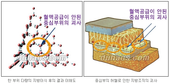 [Duhan Plastic Surgery Facial Autologous Fat Grafting] - [Fat Grafting Guide] image 16
