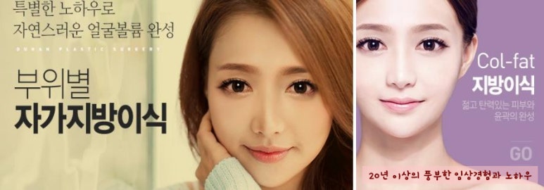 [Duhan Plastic Surgery Facial Fat Grafting] - [Fat Grafting Rhinoplasty] image 1