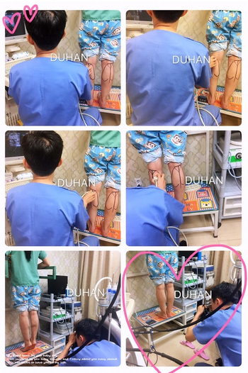 [Duhan Plastic Surgery Calf Clinic] - [Calf Contouring Guide] image 43