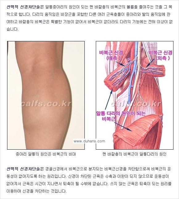 [두한성형외과 경쟁력 멀티종아리성형] - [종아리성형 방법별 전후 주의사항] 관련 이미지 4