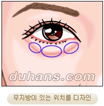 두한성형외과 지방제거 - 눈밑지방, 눈꺼풀지방제거 관련 이미지 13
