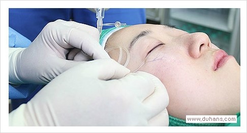 [두한성형외과 경쟁력 눈밑성형] - [눈밑 푸른 혈관 치료방법] 관련 이미지 4