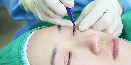[Duhan Plastic Surgery Eye Area Surgery] - [Dark Circles and Aegyo-sal] image 6