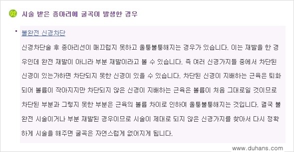 ​[두한성형외과와 날씬한 종아리 만들기!] - [간편하고 안전한 종아리 축소방법 ⑤] 관련 이미지 7