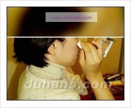 [두한성형외과 경쟁력 흉터성형] - [세가지 시술로 효과적인 함몰 흉터 교정] 관련 이미지 6