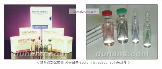 [두한성형외과 경쟁력 정맥류 치료] - [정맥류 치료의 모든 것] 관련 이미지 8