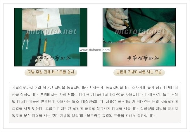 [두한성형외과 경쟁력 눈밑성형] - [눈밑 다크써클, 눈밑 주름의 교정 안내 1.] 관련 이미지 12