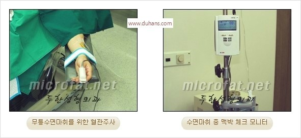 [두한성형외과 경쟁력 윤곽성형] - [3차원 미세지방이식을 이용한 이마성형, 인디언밴드 교정] 관련 이미지 6