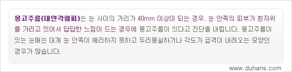 [두한성형외과 NO.1 눈성형] - [몽고주름 제거(앞트임 수술) 1.] 관련 이미지 4