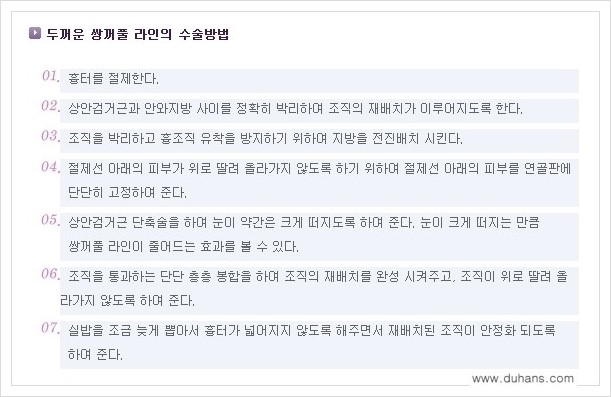 [두한성형외과 경쟁력 쌍꺼풀 재수술, 극한 재수술] - [두꺼운 쌍꺼풀 라인의 교정 방법 안내] 관련 이미지 3