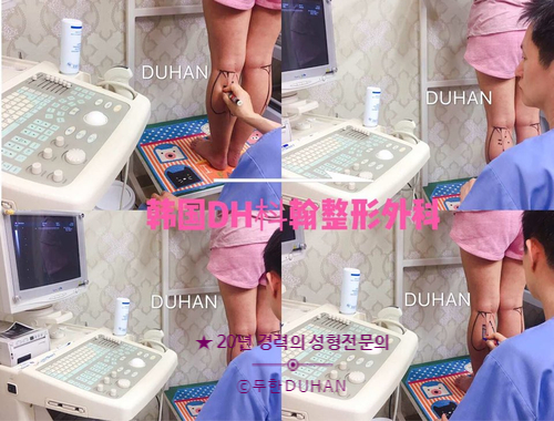 [두한성형외과 종아리성형] - [종아리알수술] 관련 이미지 31