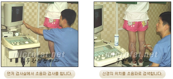 [Duhan Plastic Surgery Clinic Calf Contouring] - [Calf Reduction] image 6