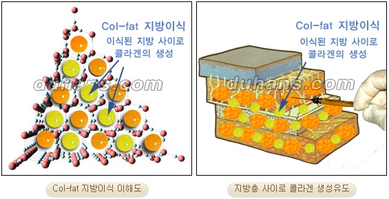 [Duhan Plastic Surgery Facial Autologous Fat Grafting] - [Fat Grafting Guide] image 17