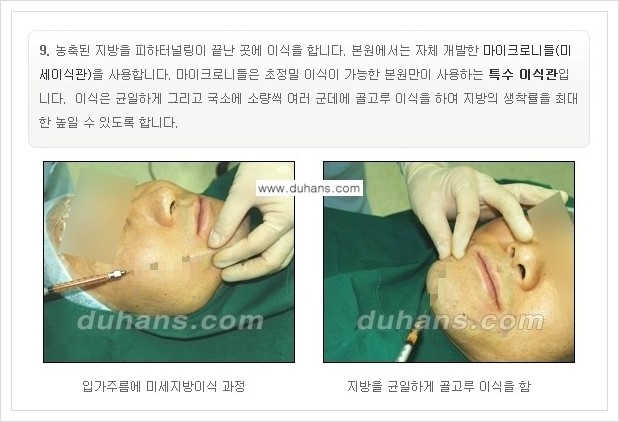 [두한성형외과 경쟁력 미세지방이식] - [부드럽고 아름다운 얼굴선 만들기, 얼굴 미세지방이식 과정 안내] 관련 이미지 8