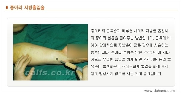 ​[두한성형외과 경쟁력 멀티종아리 성형] - [정교한 미세흡입관 지방흡입술 안내 ②] 관련 이미지 9