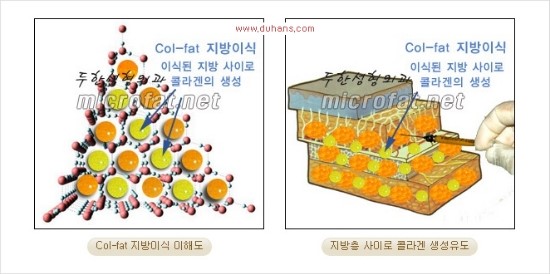 [두한성형외과 경쟁력 지방이식 리더] - [Col-fat(콜펫)지방이식, 3차원 입체지방이식, 2차원 평면지방이식] 관련 이미지 2