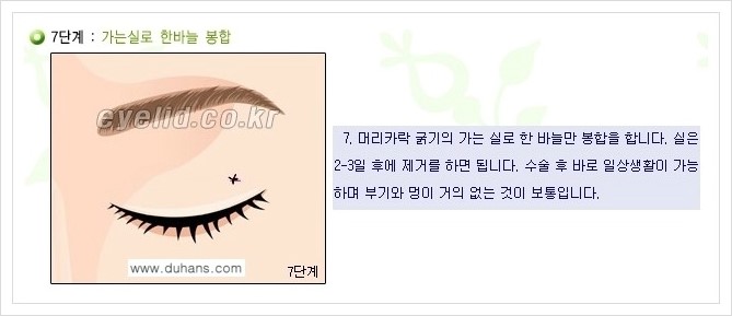 [두한성형외과 경쟁력 지방제거] - [윗눈꺼풀 지방제거, 아랫 눈꺼풀 지방제거  안내 1.] 관련 이미지 9
