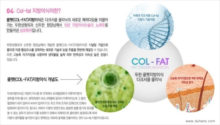 [두한성형외과 FOCUS 눈밑성형] - [다크써클의 치료방법 -  콜펫(Col-fat) 눈밑 미세지방이식 ③] 관련 이미지 4