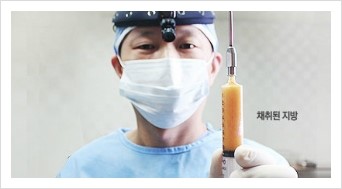 [Dr. 컬럼] - [주름교정을 위한 미세지방이식] 관련 이미지 7